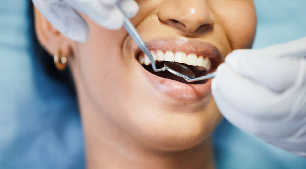 Best Broken or Chipped Tooth Repair in Green Springs, OH