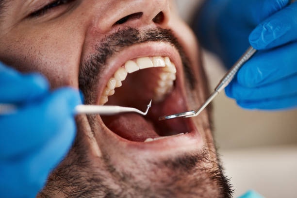 Best Emergency Dental Care for Sports Injuries in Green Springs, OH